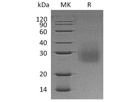 Recombinant Human HVEM/TNFRSF14 Protein (His Tag) - ABMIUM