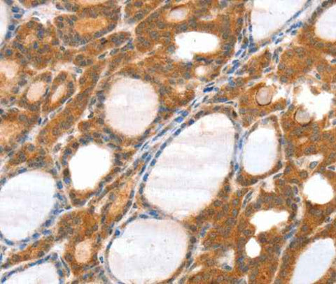Anti-Human/Mouse SRGAP3 Antibody