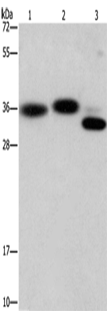 Anti-Human/Mouse/Rat CAPZA2 Antibody - ABMIUM