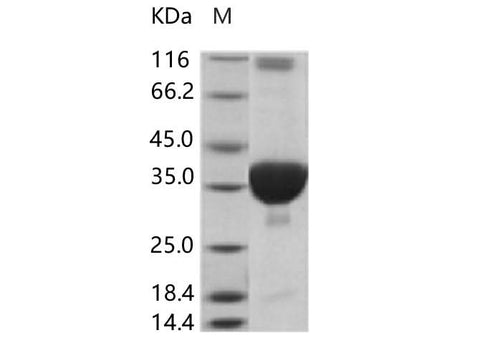 Recombinant SARS-CoV Plpro/papain-like protease (His Tag) - ABMIUM