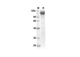 SDS-PAGE analysis of Rat gp130 proteins, 2 μg/lane of Recombinant Rat gp130 proteins was resolved with an SDS-PAGE under reducing conditions, showing bands at 90.4 kDa.
