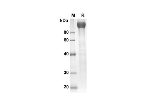 SDS-PAGE analysis of Rat gp130 proteins, 2 μg/lane of Recombinant Rat gp130 proteins was resolved with an SDS-PAGE under reducing conditions, showing bands at 90.4 kDa.