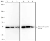 Anti-Human/Rat/Mouse GLUT2 Antibody [A403]