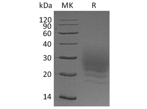 Recombinant Human BOC Protein (His Tag) - ABMIUM