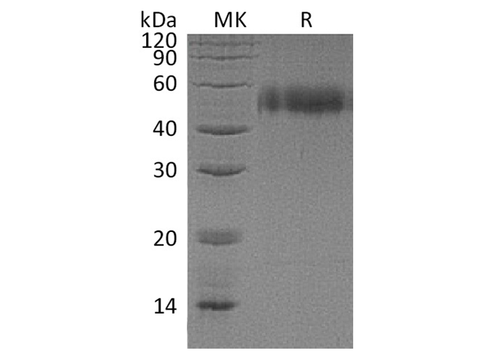 Recombinant Human uPAR Protein (His Tag) - ABMIUM
