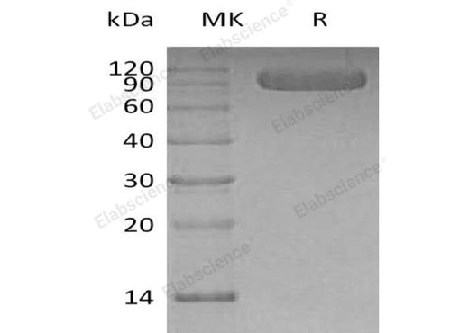Recombinant Human Vasorin/VASN Protein (His Tag) - ABMIUM