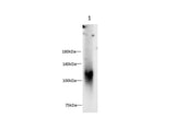 Anti-Human Osteoactivin Antibody - ABMIUM
