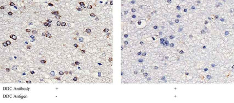 Anti-Human DDC Antibody [B266] - ABMIUM