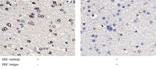 Anti-Human DDC Antibody [B266] - ABMIUM