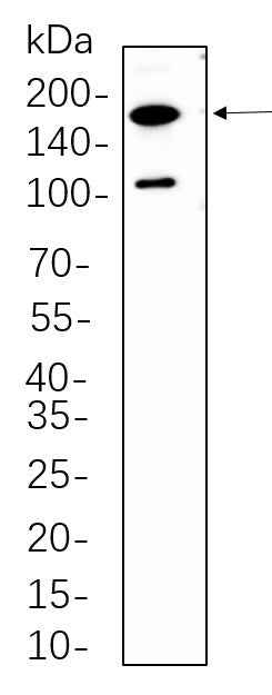 Anti-Human/Mouse Rictor Antibody [B638] - ABMIUM