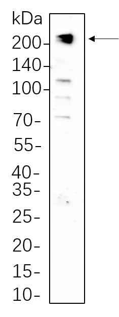 Anti-Human/Mouse/Rat/Rabbit PDGFR-β Antibody [B756] - ABMIUM