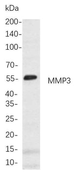 Anti-Human/Mouse/Rat MMP3 Antibody [B771]