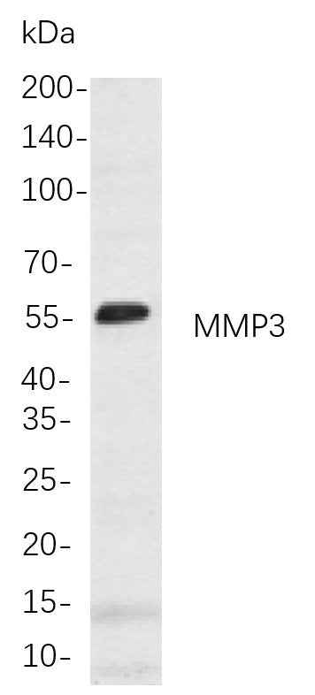 Anti-Human/Mouse/Rat MMP3 Antibody [B771] - ABMIUM