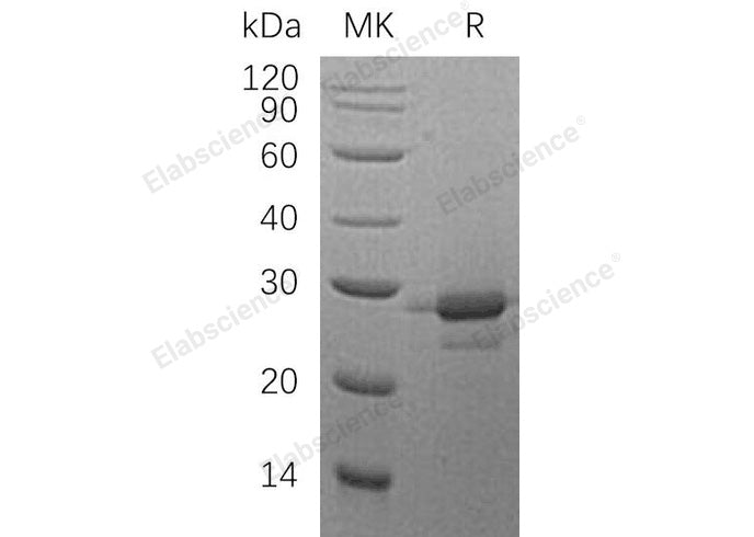 Recombinant Human MOB1A Protein (His Tag) - ABMIUM
