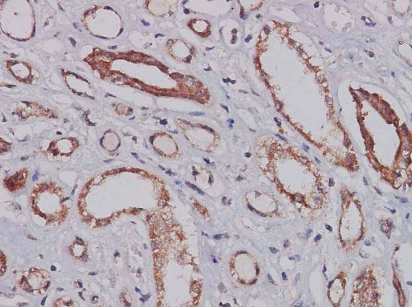 Anti-Human CXCL14 Antibody - ABMIUM
