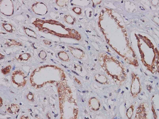 Anti-Human CXCL14 Antibody - ABMIUM