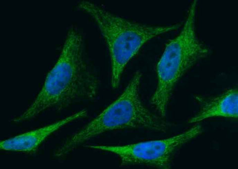 Anti-Human BID Antibody [A1170] - ABMIUM