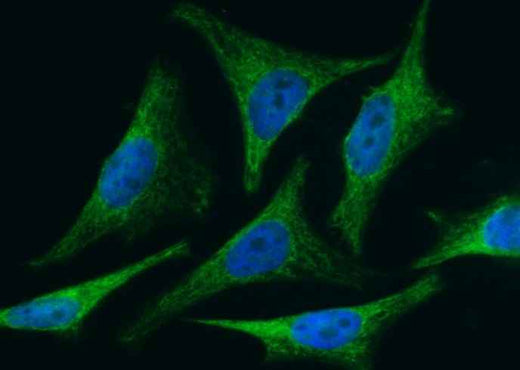 Anti-Human BID Antibody [A1170] - ABMIUM