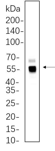 Anti-Human/Mouse/Rat/Pig/Chicken Caspase-8 Antibody [B1090] - ABMIUM