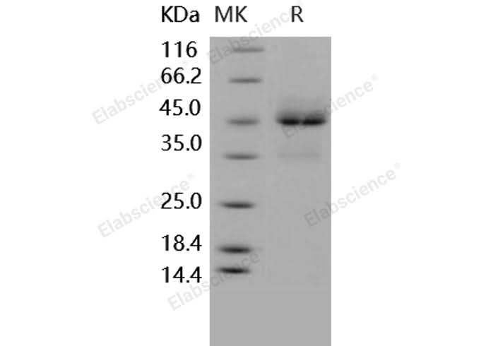 Recombinant Human TRAILR1/TNFRSF10A Protein (Fc Tag) - ABMIUM
