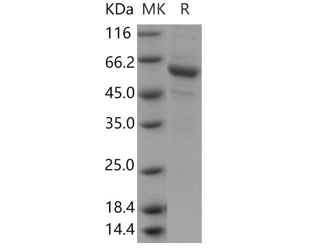 > 87 % as determined by reducing SDS-PAGE.