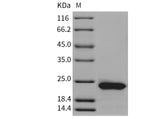 Recombinant Rat RBP4 Protein (His Tag) - ABMIUM