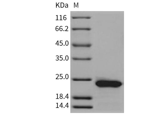 Recombinant Rat RBP4 Protein (His Tag) - ABMIUM