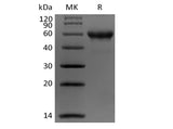 Recombinant Human Carbonic Anhydrase IX/CA9 (C-Avi-6His) Biotinylated - ABMIUM