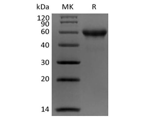 Recombinant Human Carbonic Anhydrase IX/CA9 (C-Avi-6His) Biotinylated - ABMIUM