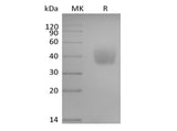 Recombinant Human SLAM Family Member 6/SLAMF6/CD352/NTB-A (C-6His-Avi) Biotinylated - ABMIUM