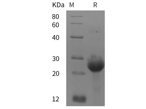 SDS-PAGE analysis of Human ABL1/c-Abl proteins, 2 μg/lane of Recombinant Human ABL1/c-Abl proteins was resolved with SDS-PAGE under reducing conditions, showing bands at 25 kDa.