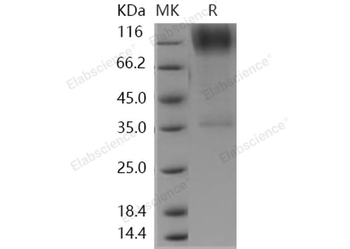 Recombinant Human B3GNT2 Protein (Fc Tag) - ABMIUM
