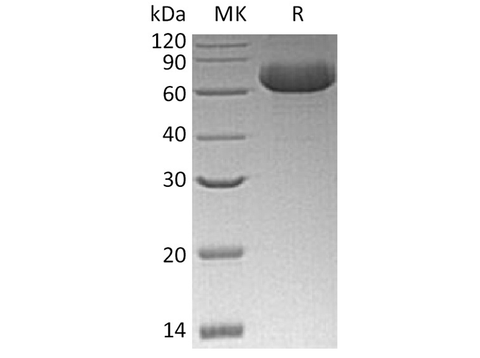 Recombinant Human GFRRA2 Protein (His Tag) - ABMIUM