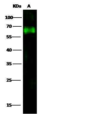Anti-Human NT5E Antibody [A1046] - ABMIUM