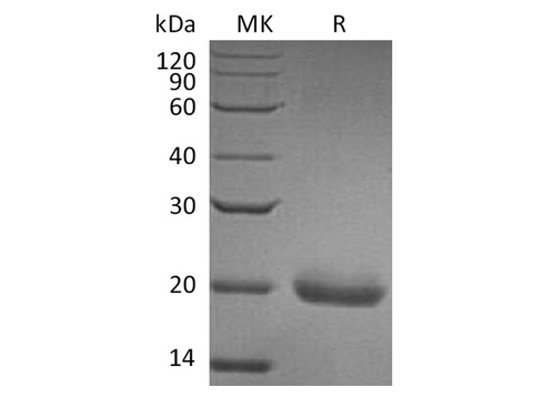 Recombinant Human SECTM1 Protein (His Tag) - ABMIUM