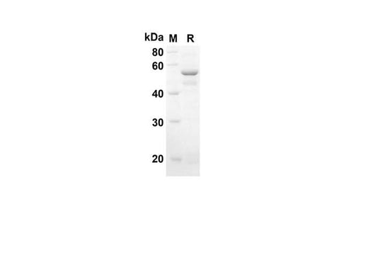 SDS-PAGE analysis of Mouse Sh3yl1 proteins, 2 μg/lane of Recombinant Mouse Sh3yl1 proteins was resolved with an SDS-PAGE under reducing conditions, showing bands at 50.3 kDa.