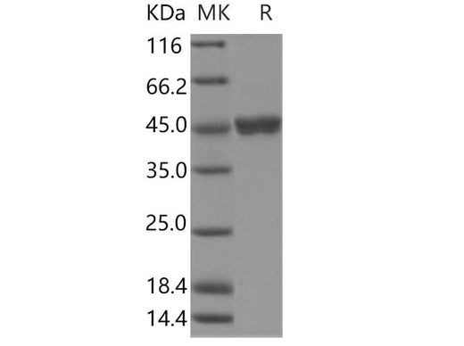 Recombinant Human Gastric Lipase/LIPF Protein (Baculovirus, His Tag) - ABMIUM