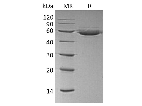 Recombinant Human CTLA4 Protein (Fc & Avi Tag) - ABMIUM