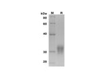SDS-PAGE analysis of Human CD32b/FCGR2B proteins, 2 μg/lane of Recombinant Human CD32b/FCGR2B proteins was resolved with SDS-PAGE under reducing conditions, showing bands at 30-35 kDa.