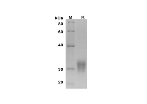 SDS-PAGE analysis of Human CD32b/FCGR2B proteins, 2 μg/lane of Recombinant Human CD32b/FCGR2B proteins was resolved with SDS-PAGE under reducing conditions, showing bands at 30-35 kDa.