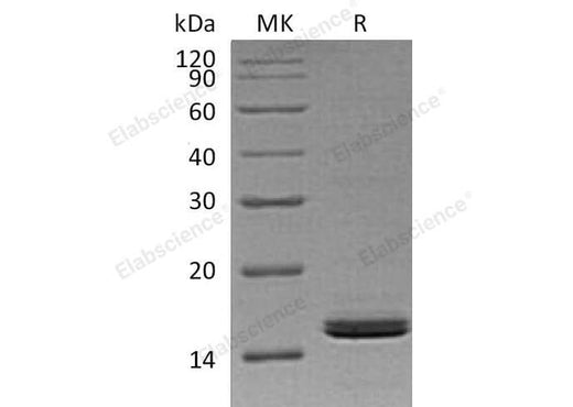 Recombinant Human Retinol-Binding Protein 2/RBP2 Protein - ABMIUM