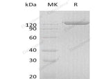 Recombinant Human PIGR Protein (Fc Tag) - ABMIUM