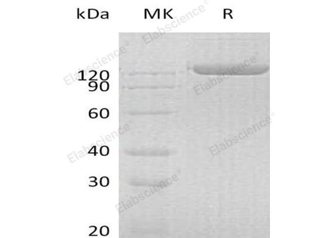 Recombinant Human PIGR Protein (Fc Tag) - ABMIUM
