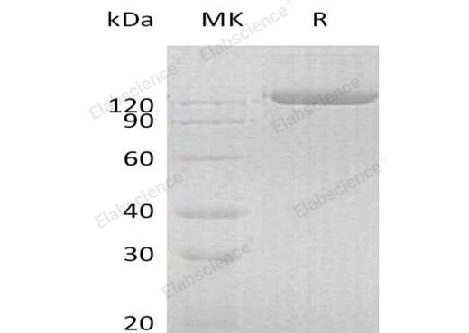 Recombinant Human PIGR Protein (Fc Tag) - ABMIUM