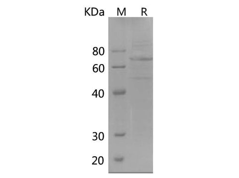 SDS-PAGE analysis of Human LILRB3 proteins, 2 μg/lane of Recombinant Human LILRB3 proteins was resolved with SDS-PAGE under reducing conditions, showing bands at 70 kDa.