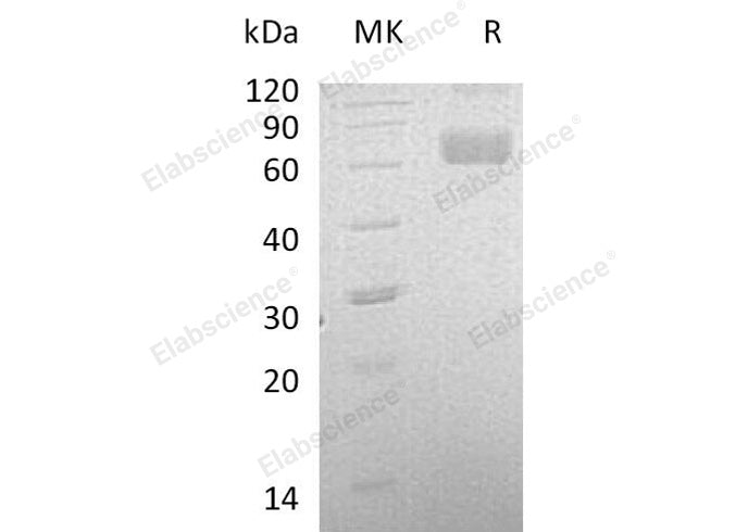 Recombinant Human LCAT Protein (His Tag) - ABMIUM