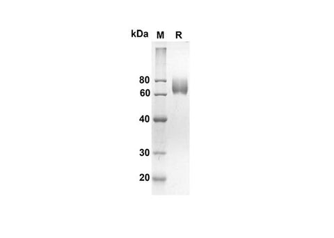 SDS-PAGE analysis of Human MICB proteins, 2 μg/lane of Recombinant Human MICB proteins was resolved with an SDS-PAGE under reducing conditions, showing bands at 55.2 kDa.