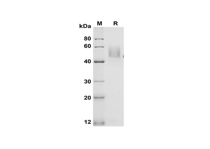 SDS-PAGE analysis of Mouse GITR/TNFRSF18 proteins, 2 μg/lane of Recombinant Mouse GITR/TNFRSF18 proteins was resolved with SDS-PAGE under reducing conditions, showing bands at 50 kDa.