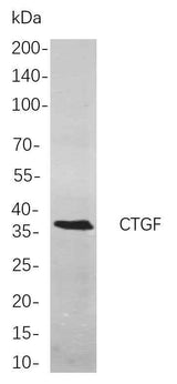 Anti-Human/Mouse/Rat CTGF Antibody [B803]