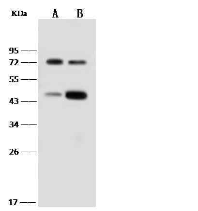 Anti-Human IL18RAP Antibody [B227] - ABMIUM